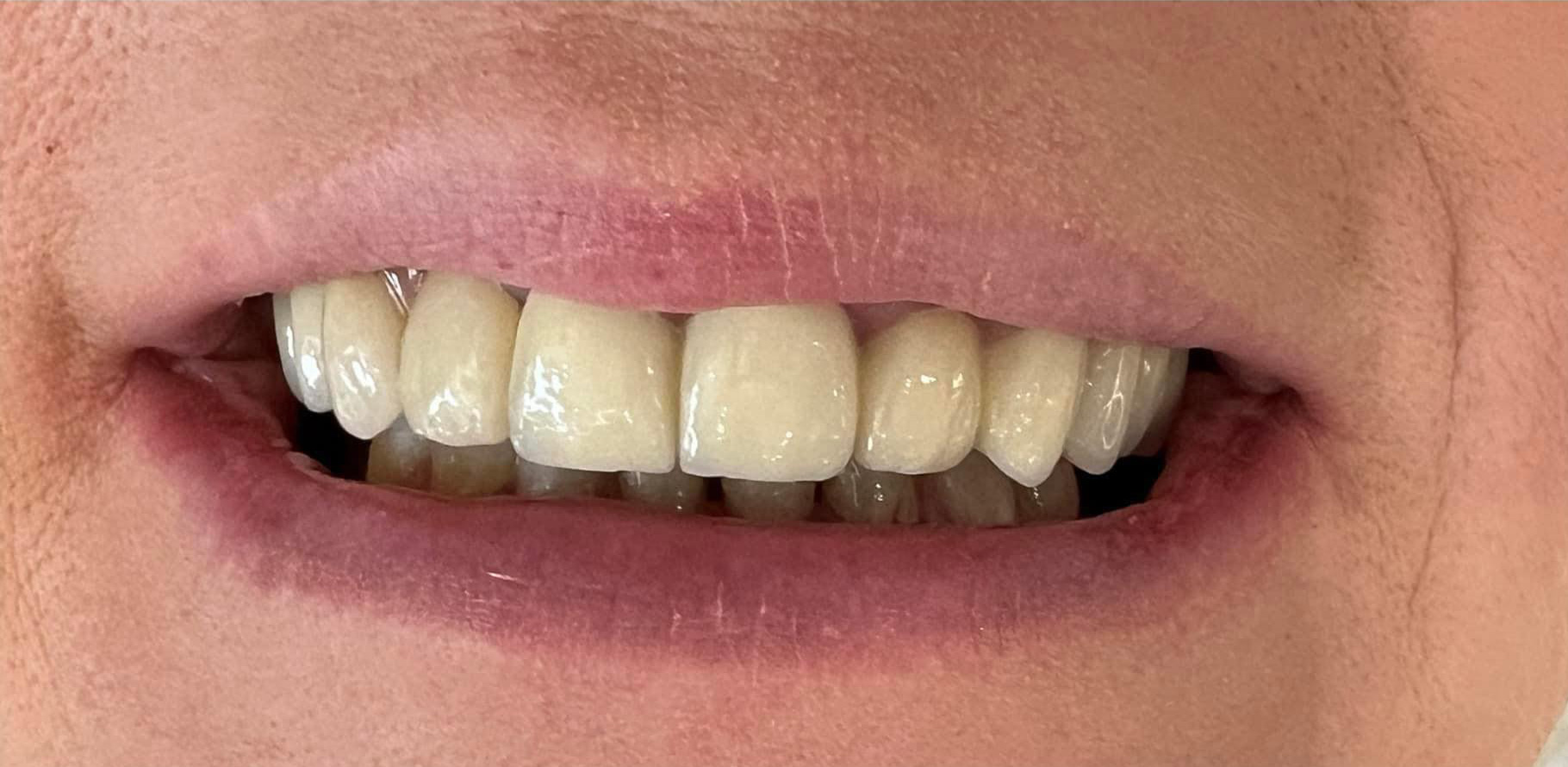 Zdjęcie po metamorfozie