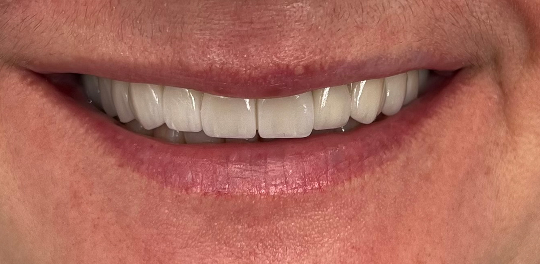 Zdjęcie po metamorfozie