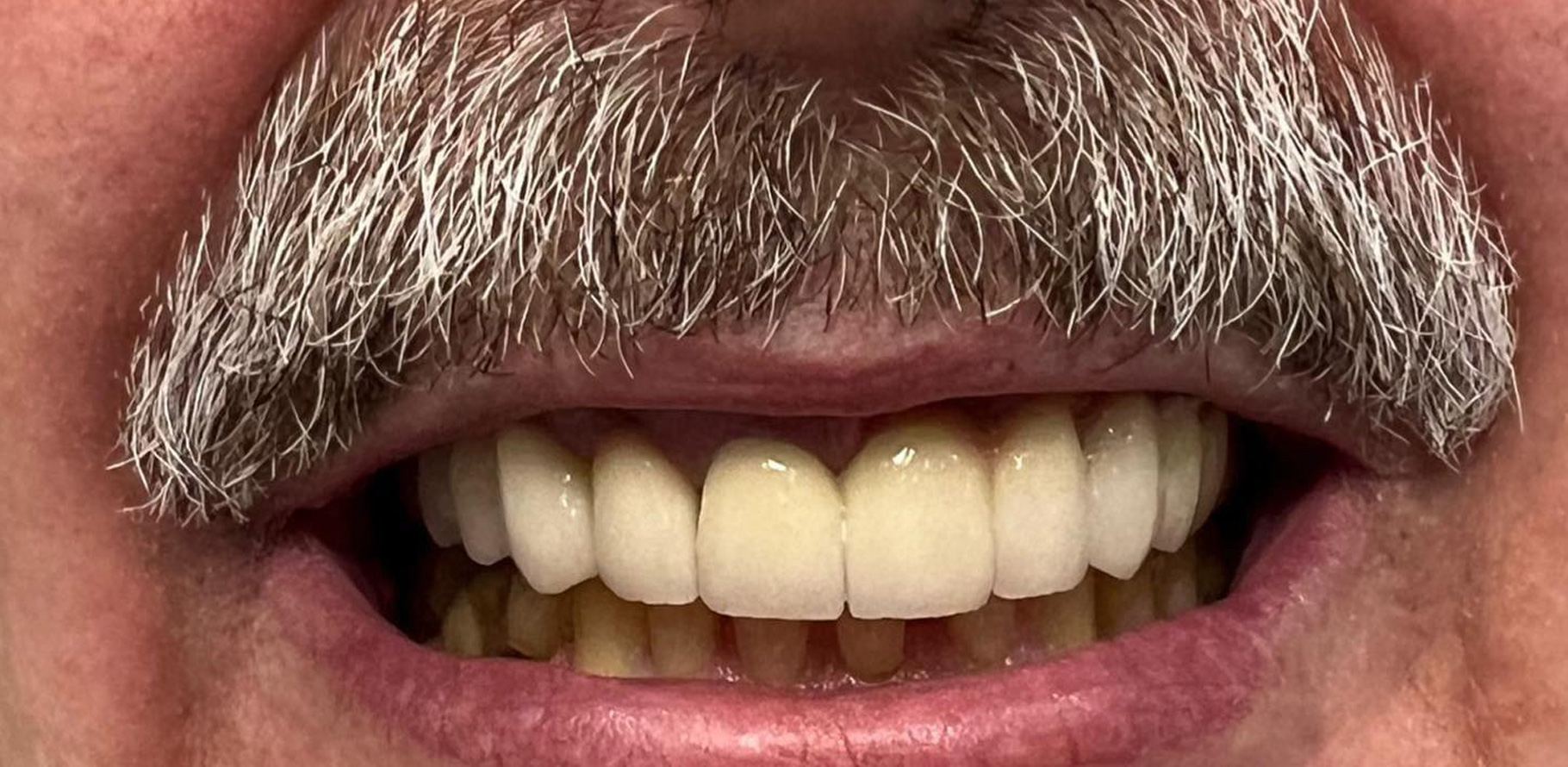 Zdjęcie po metamorfozie