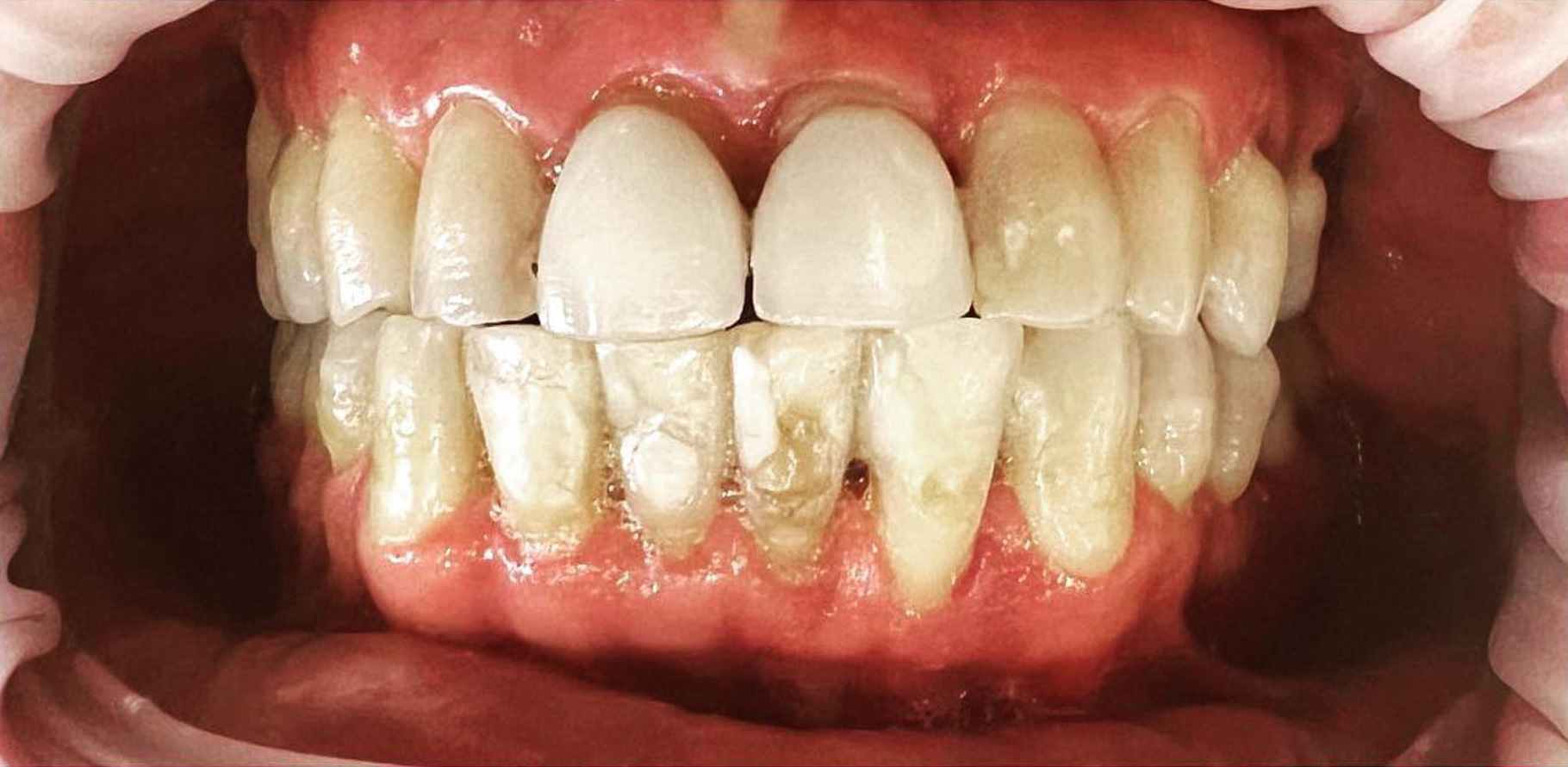 Zdjęcie przed metamorfozą