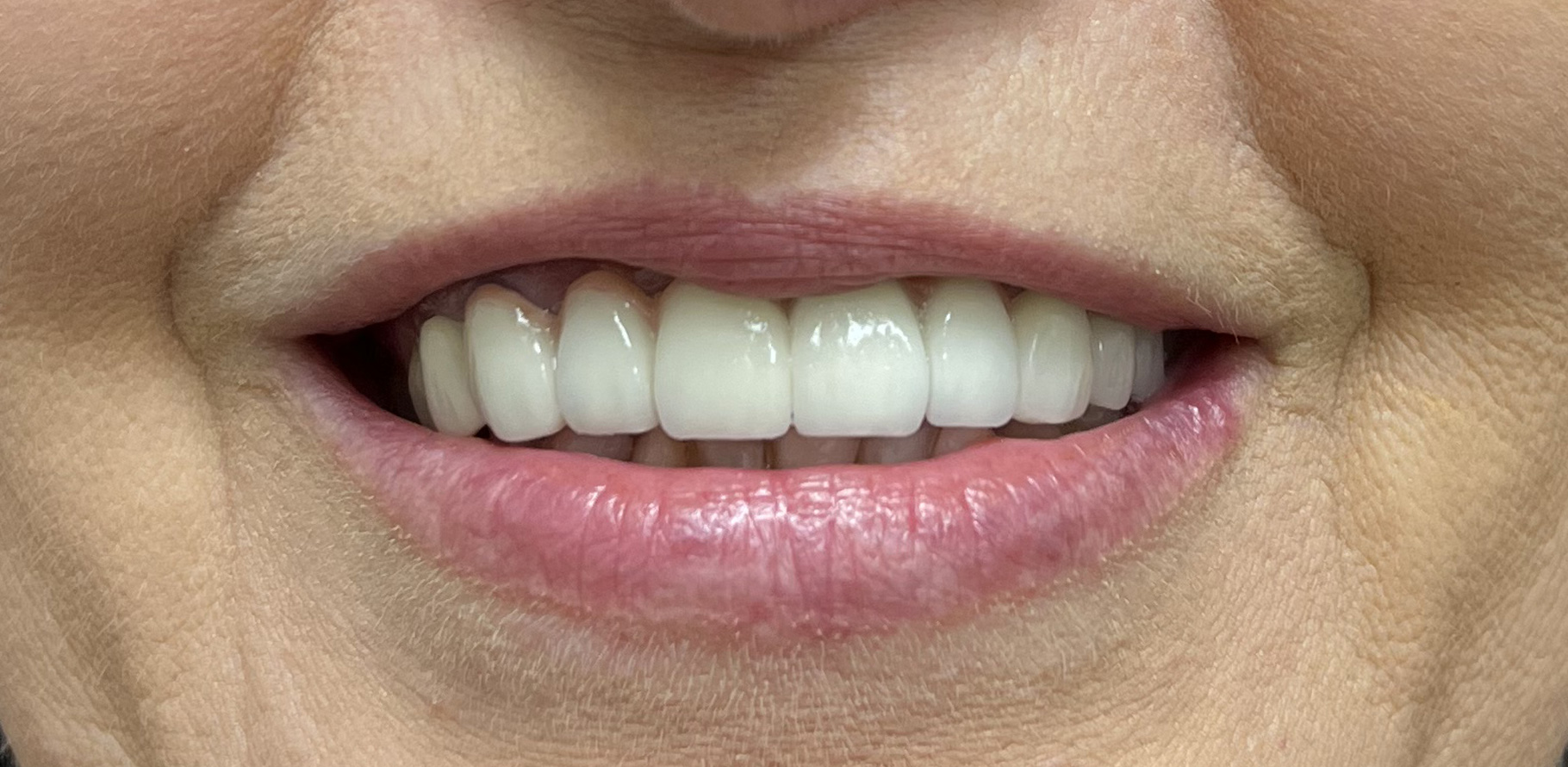 Zdjęcie po metamorfozie