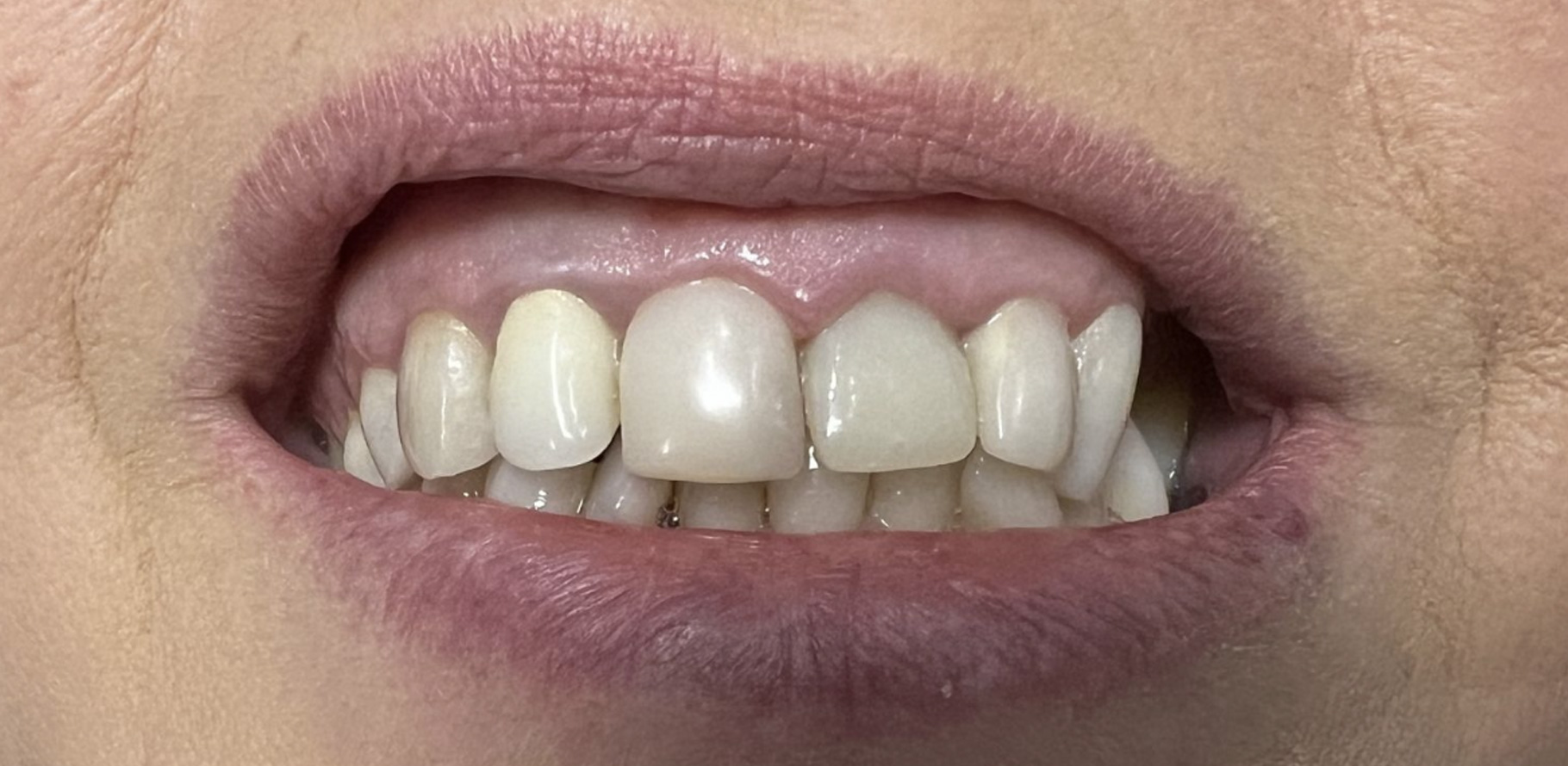 Zdjęcie przed metamorfozą