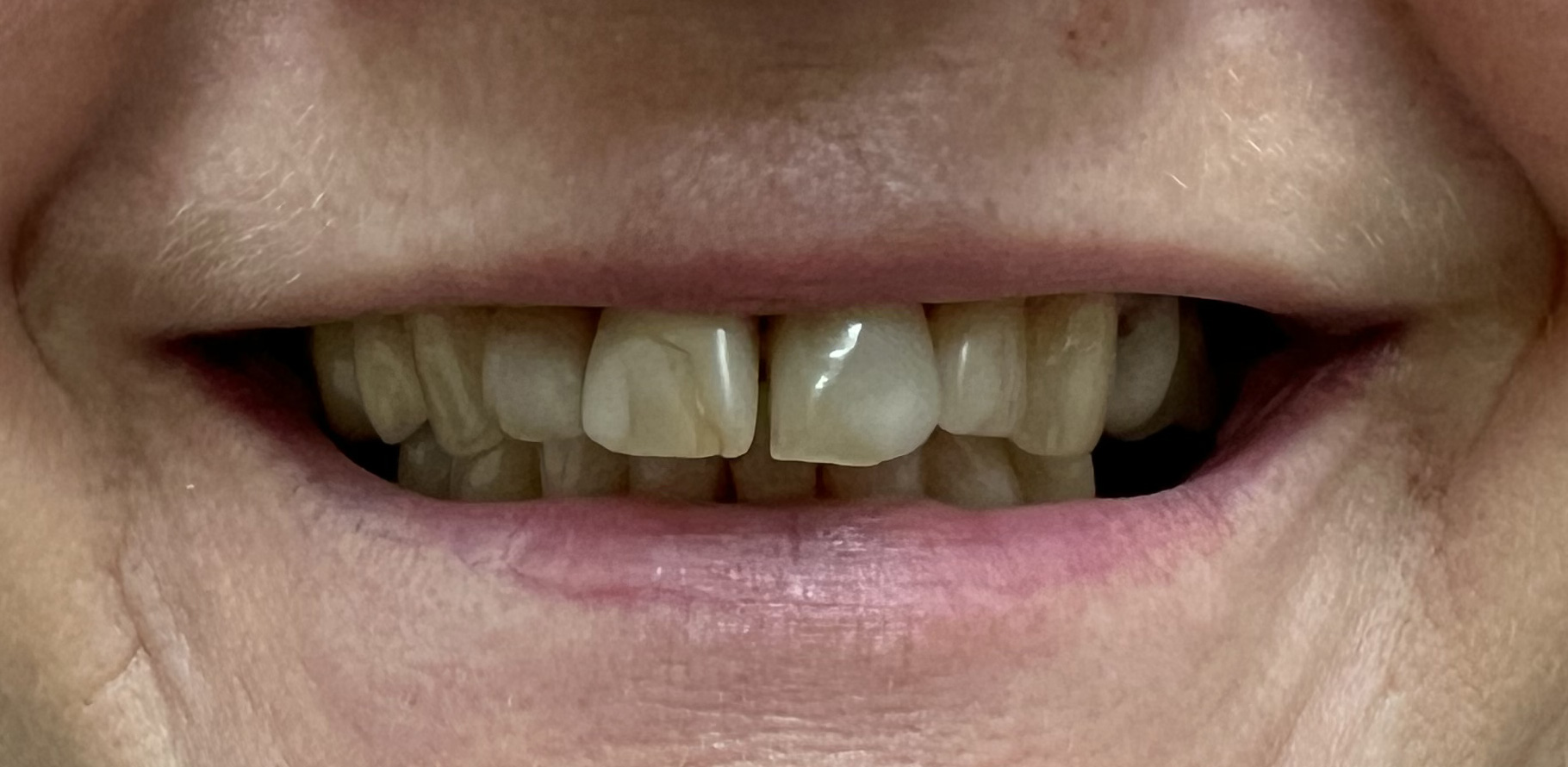 Zdjęcie przed metamorfozą