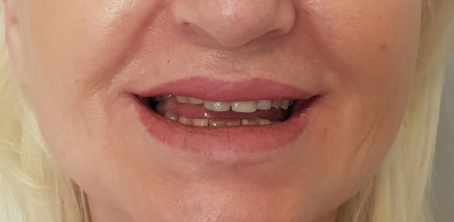 Zdjęcie przed metamorfozą