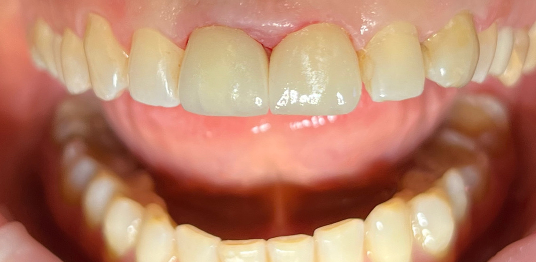 Zdjęcie po metamorfozie