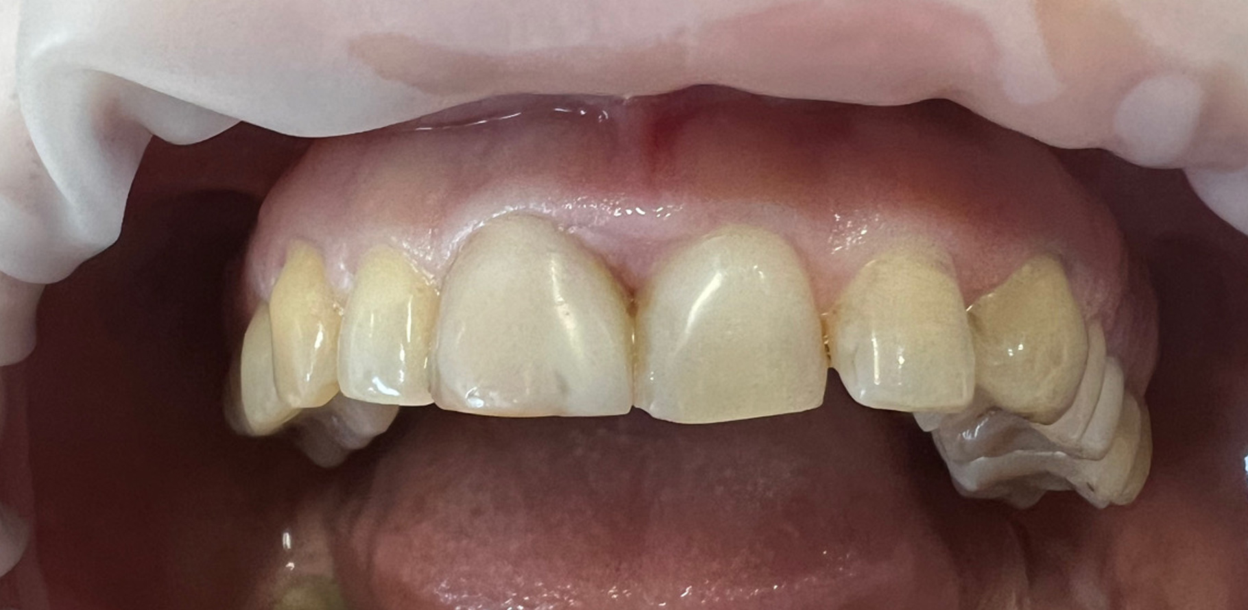 Zdjęcie przed metamorfozą