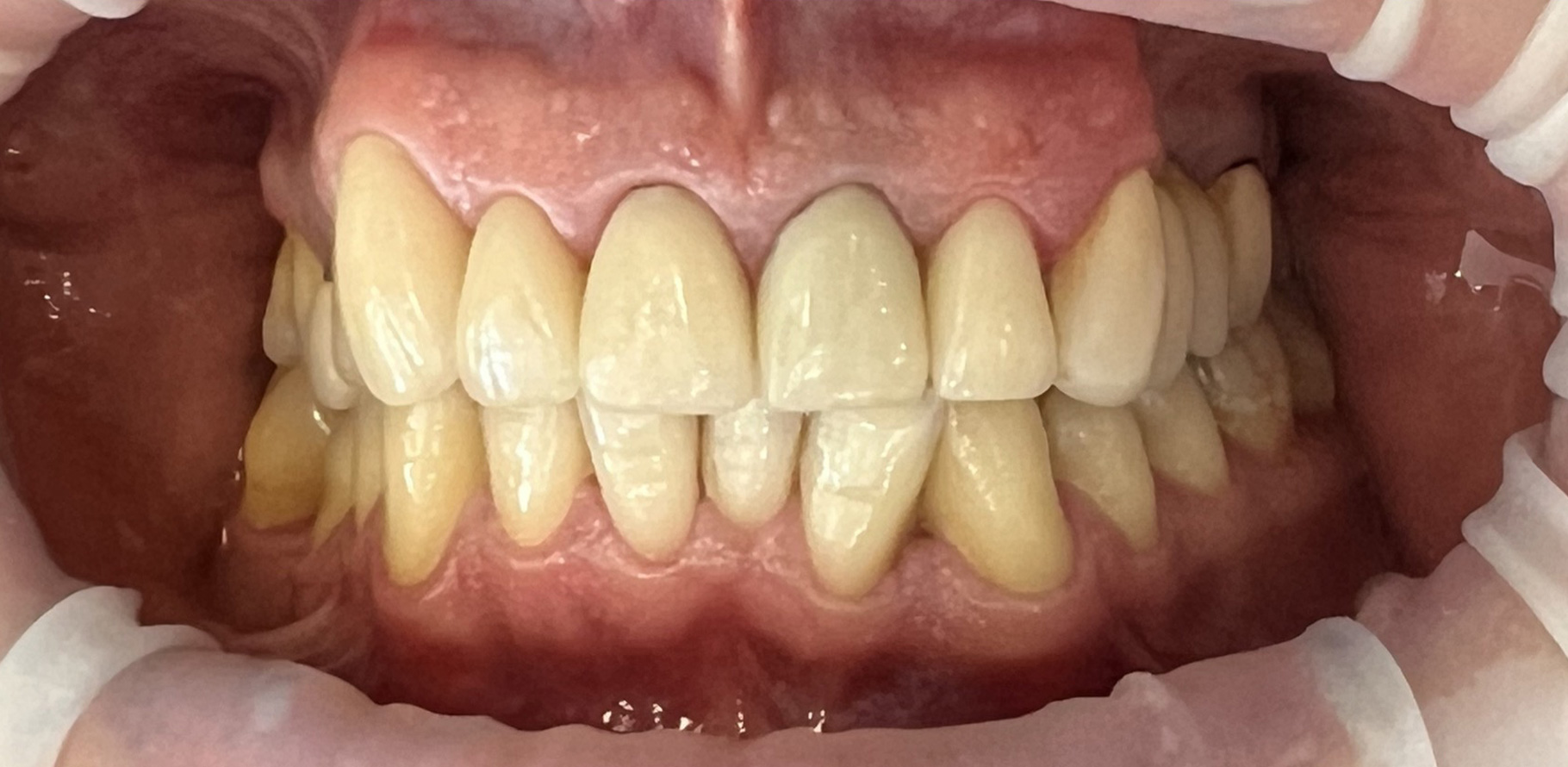 Zdjęcie po metamorfozie