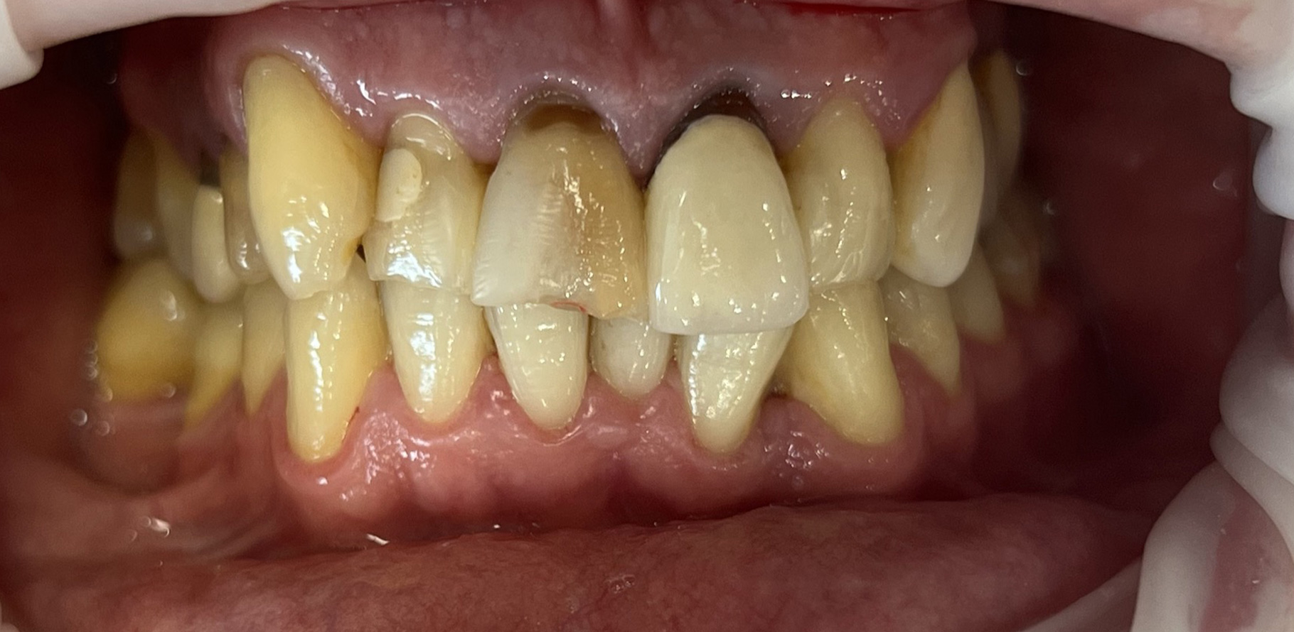 Zdjęcie przed metamorfozą