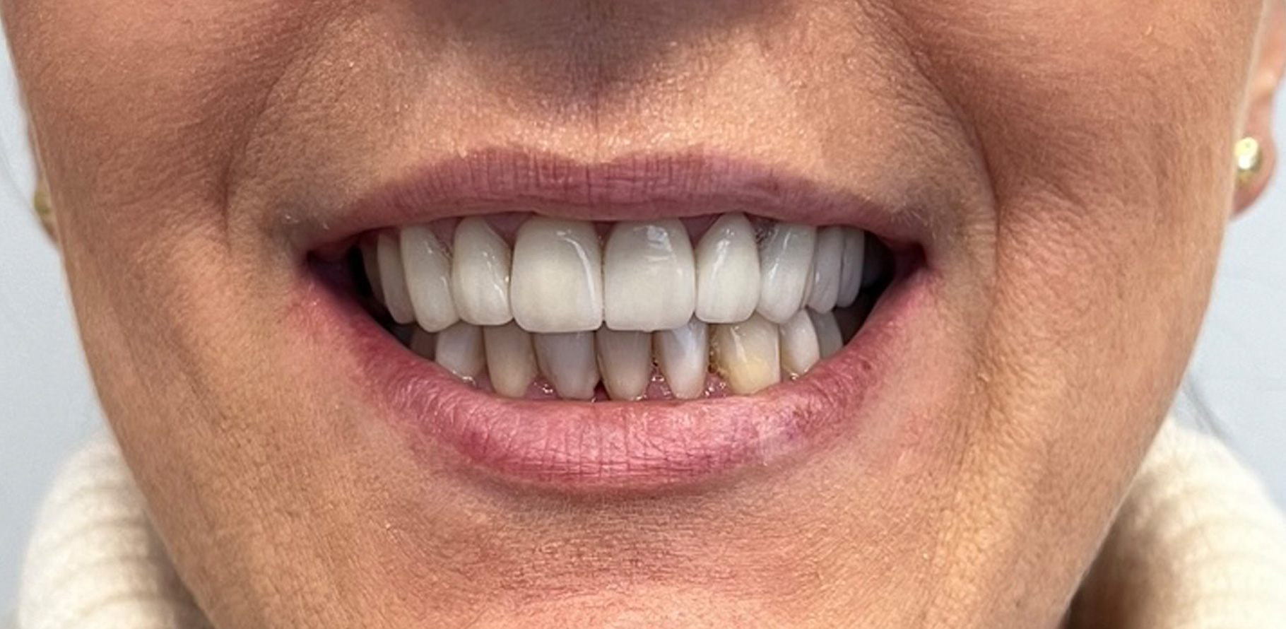 Zdjęcie po metamorfozie