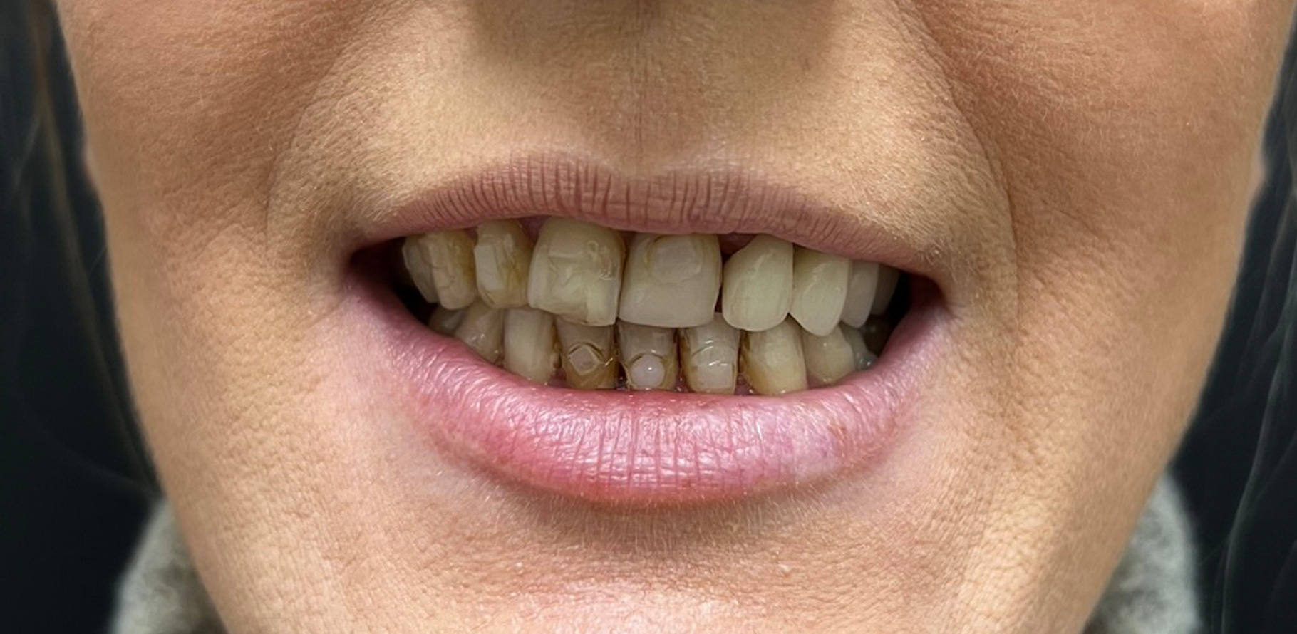 Zdjęcie przed metamorfozą