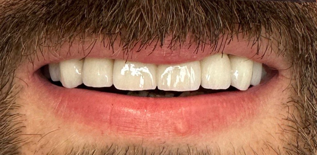 Zdjęcie po metamorfozie