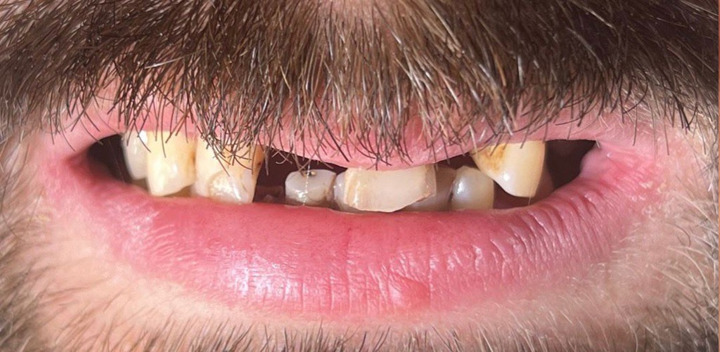 Zdjęcie przed metamorfozą